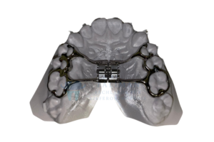 Retainer